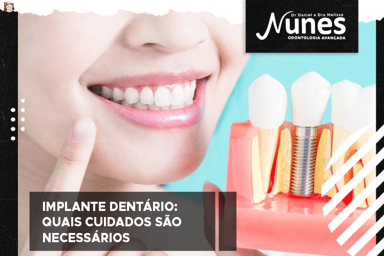 Implante dentário