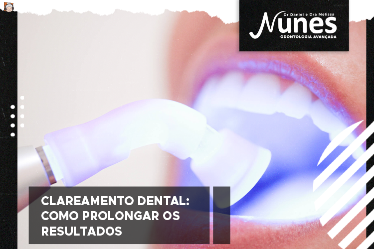 Clareamento dental