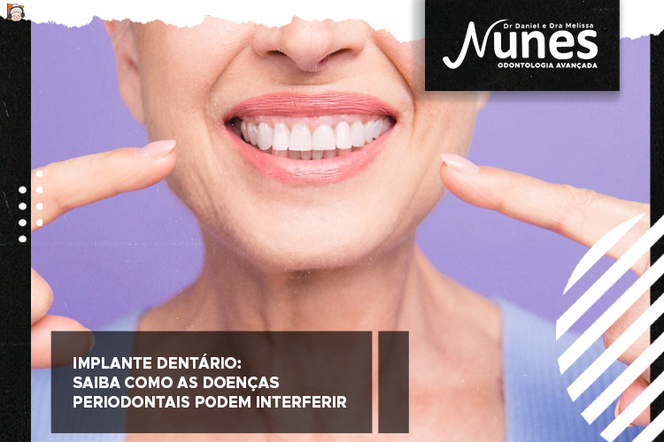 implante dentário