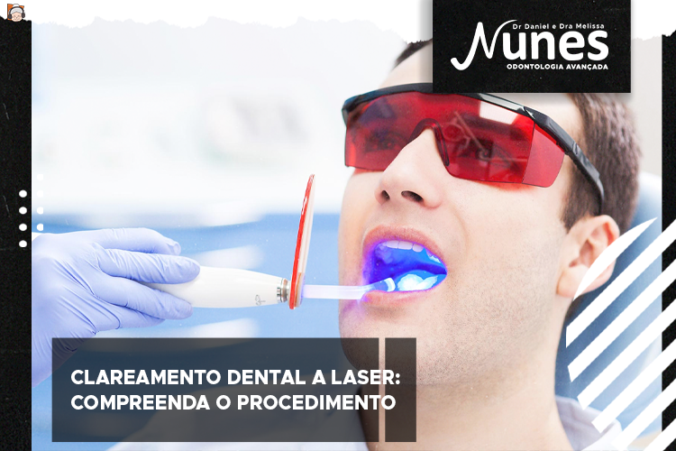 Clareamento dental