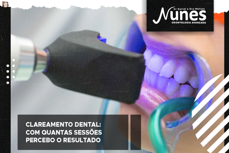 Clareamento dental