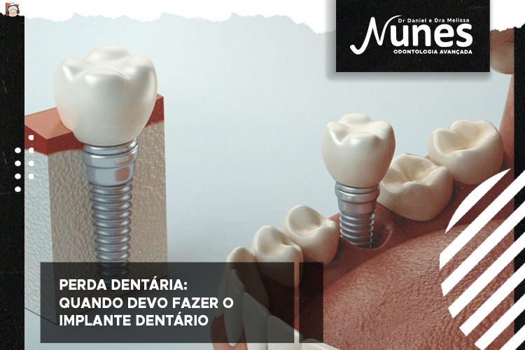 Perda dentária