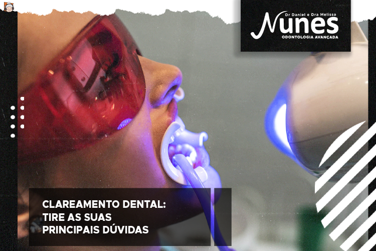 Clareamento dental