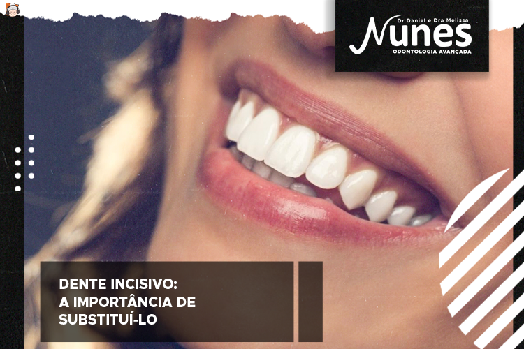 Dente incisivo